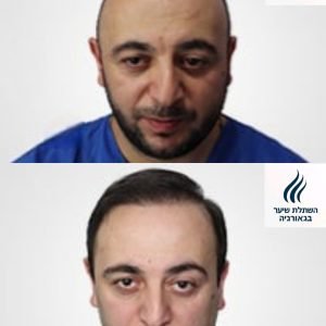 fb1599781754658637_5696